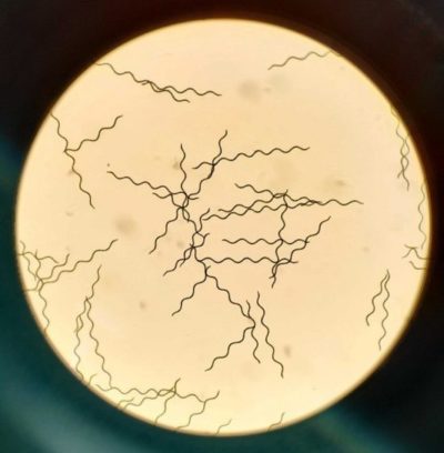 spiruline au microscope