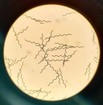 spiruline au microscope