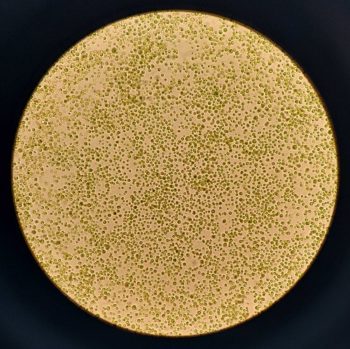 microalgue chlorelle au microscope