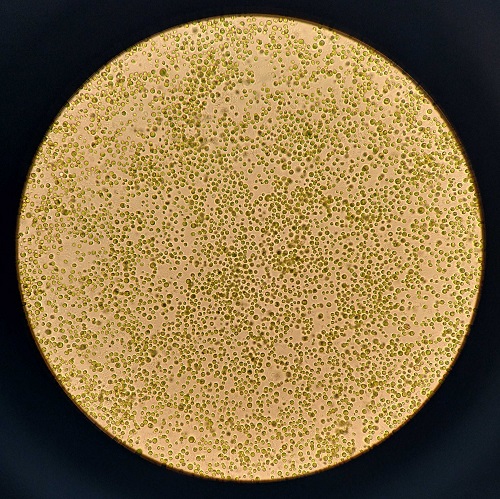 microalgue chlorelle au microscope